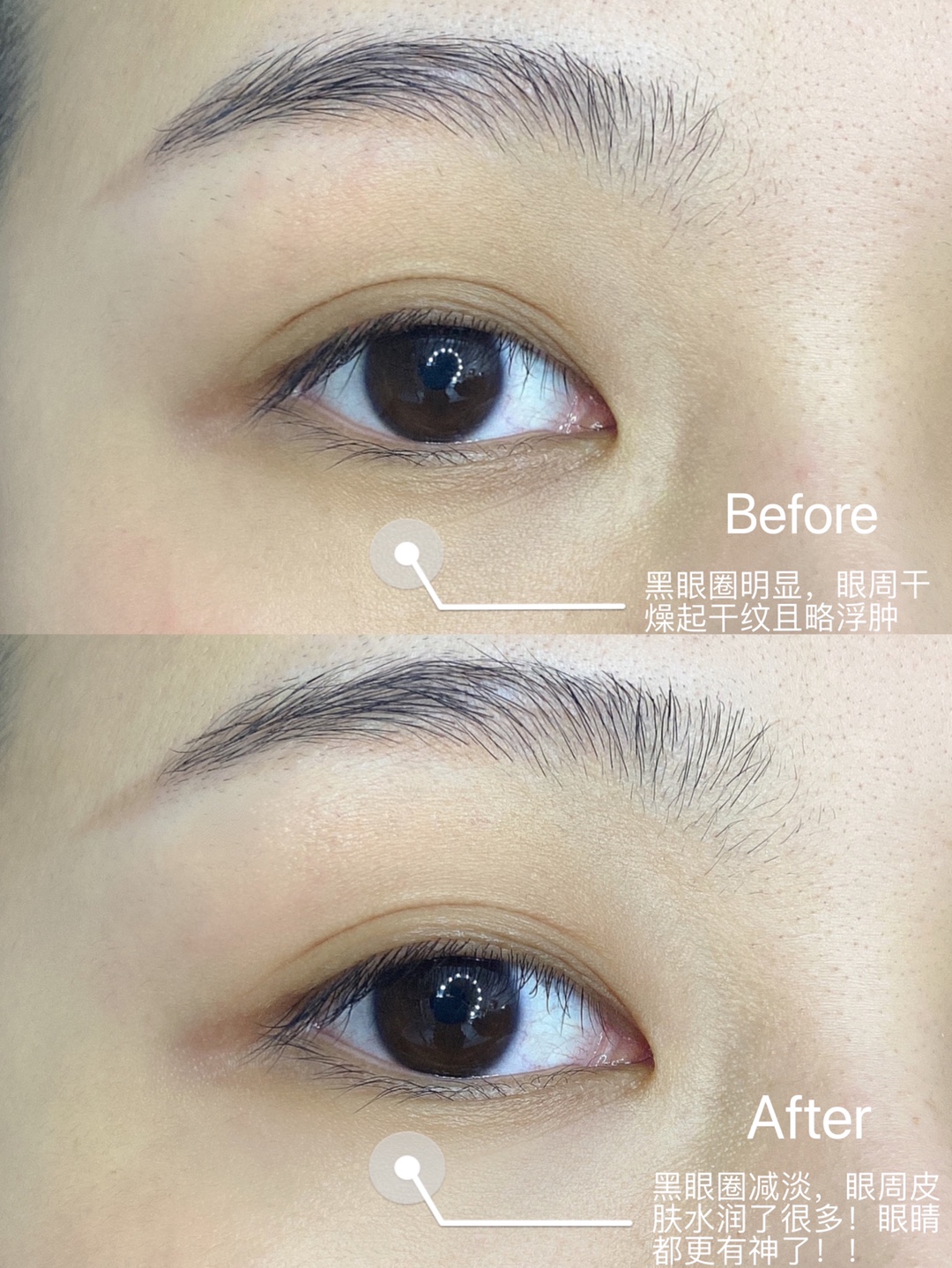 眼霜—Kerrykerry宝贝收到了，，刚用肌肤嘟噜嘟噜的喝水，，用完之后脸明显变白了，，，，很喜欢