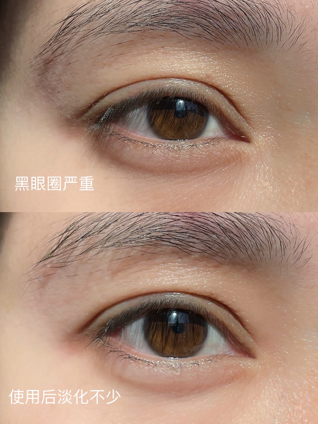 眼霜—飞奔的大湖